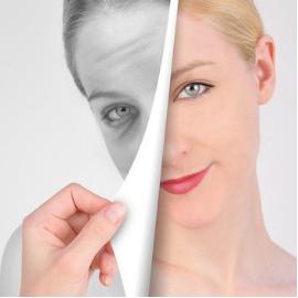 脸部紧实能做热拉提吗,黄金热拉提做完脸会肿吗