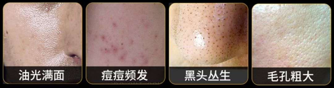 娆ц幈闆呯敺澹礂闈㈠ザ鎺ф补鐐埥娴嬭瘎,娆ц幈闆呮帶娌圭偔鐖芥礂闈㈠ザ鐢峰コ閫氱敤