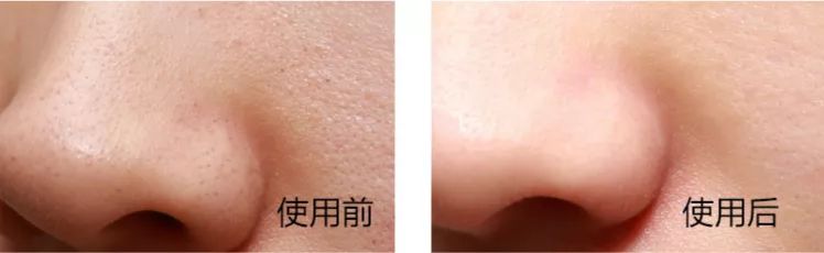 娆ц幈闆呯敺澹礂闈㈠ザ鎺ф补鐐埥娴嬭瘎,娆ц幈闆呮帶娌圭偔鐖芥礂闈㈠ザ鐢峰コ閫氱敤