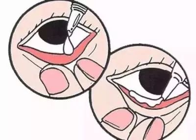 哪些你常用的眼药水其实并不靠谱,你真的了解眼药水吗