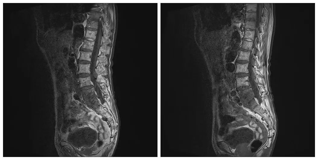 长期腰痛是什么原因引起的,长期腰痛是肾有毛病吗
