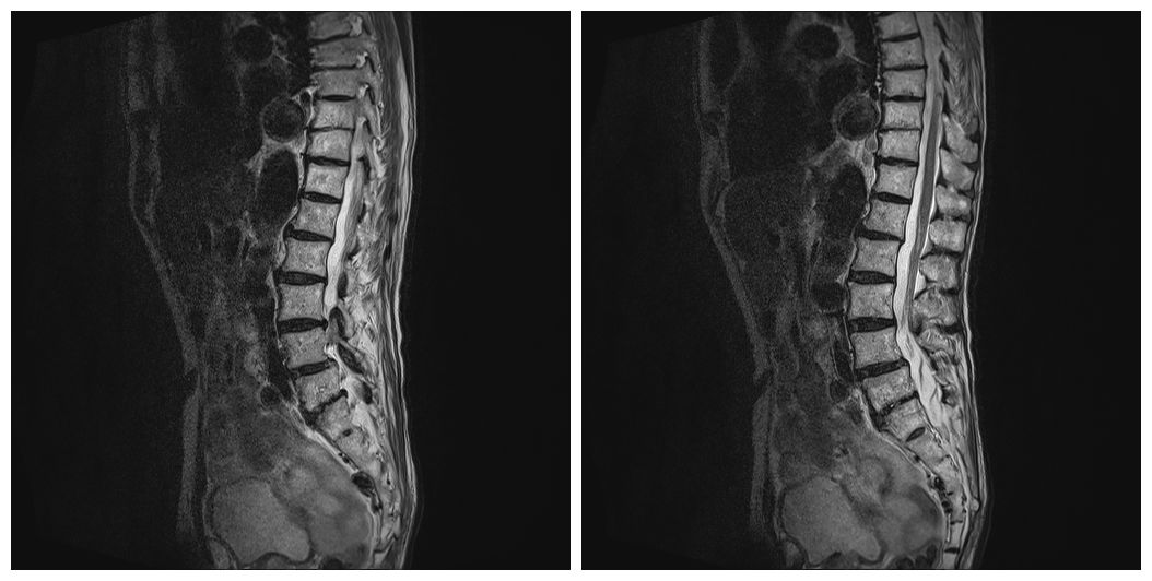 长期腰痛是什么原因引起的,长期腰痛是肾有毛病吗