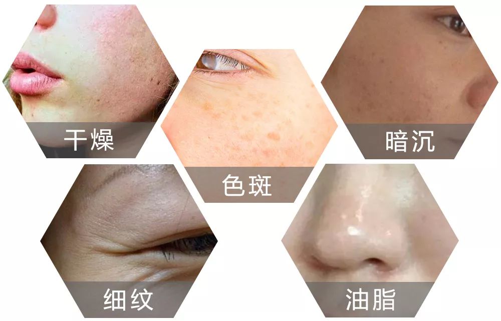 用它洗脸,脏东西自己浮出来,比做10次面膜还管用!丨开团