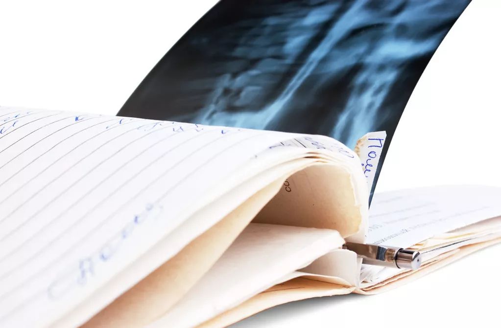 装成没患癌的模样：戴上假发，我还是“原来”的我