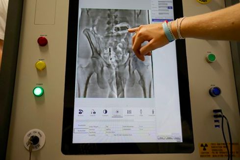 英国首相约翰逊目睹囚犯体内藏毒扫描照,竟被吓得连连*退倒**