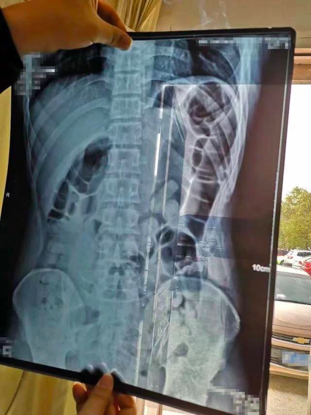 英国首相约翰逊目睹囚犯体内藏毒扫描照,竟被吓得连连*退倒**