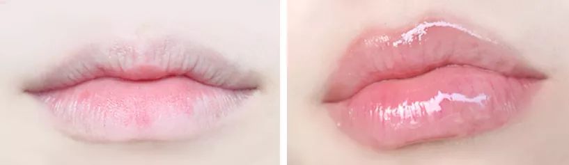 丰唇怎样让唇边更立体,适合丰唇的唇形