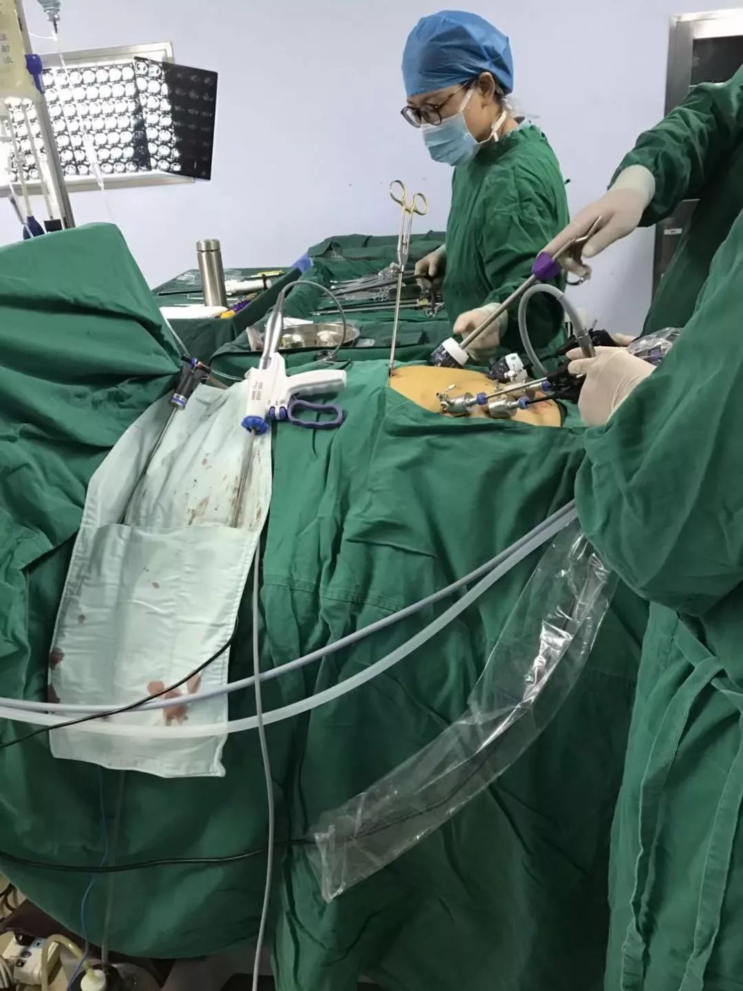 外科护士用手传递手术刀的方法,手术室护士核心能力