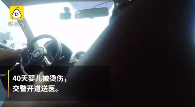 心疼!菏泽一月嫂抱仅40天男婴做饭时锅中鸡蛋突然爆开,孩子腿和肚皮烫出了泡...