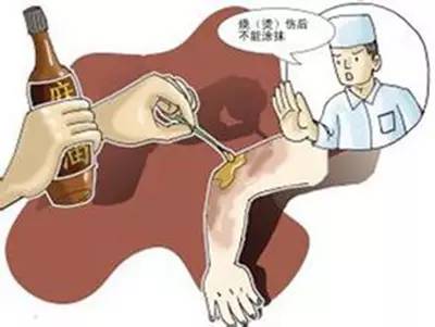 心疼!菏泽一月嫂抱仅40天男婴做饭时锅中鸡蛋突然爆开,孩子腿和肚皮烫出了泡...