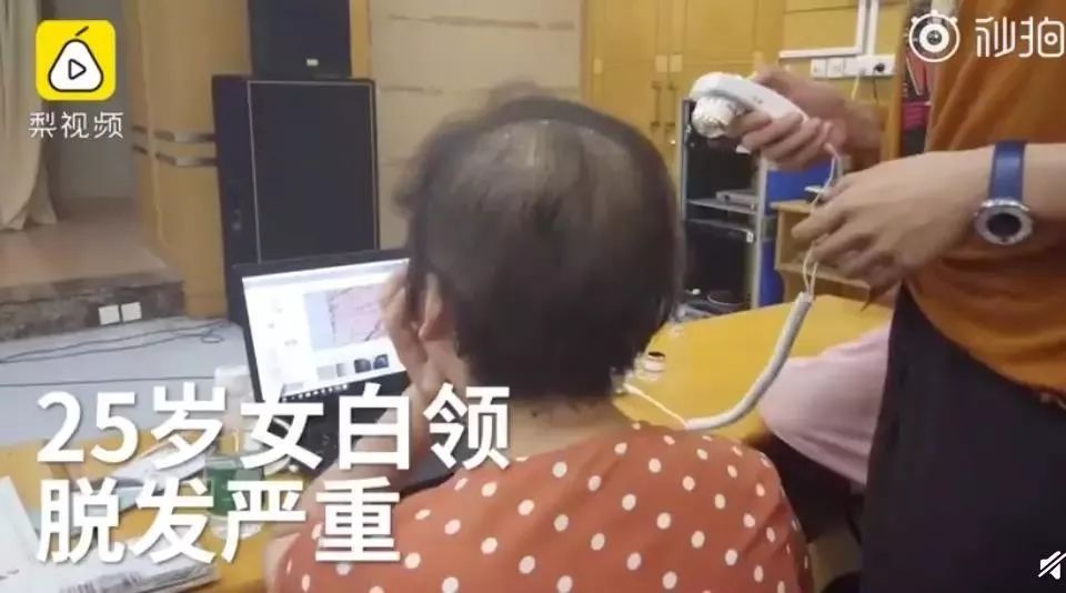 25岁女脱发真的恢复不了吗,女人头发干枯怎么预防脱发