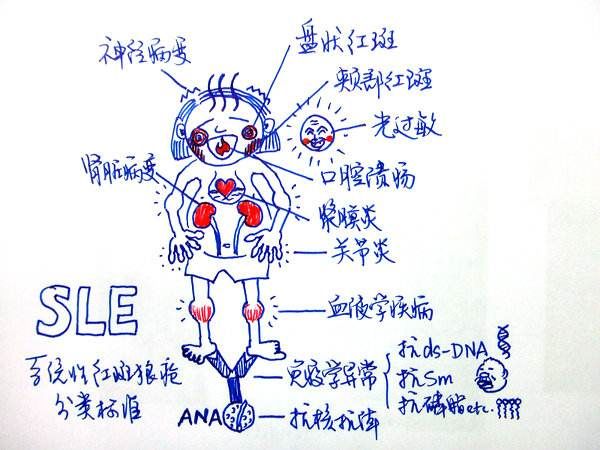 孙凌云治疗皮肌炎,孙凌云提倡打干细胞吗