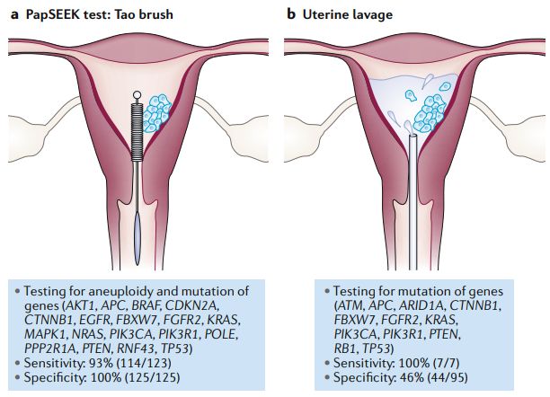 一文汇总|子宫内膜癌的分子分型及相关研究进展