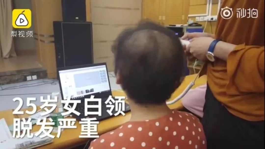 女生年纪轻轻脱发严重的几个原因,女生脱发秃顶掉发严重怎么办