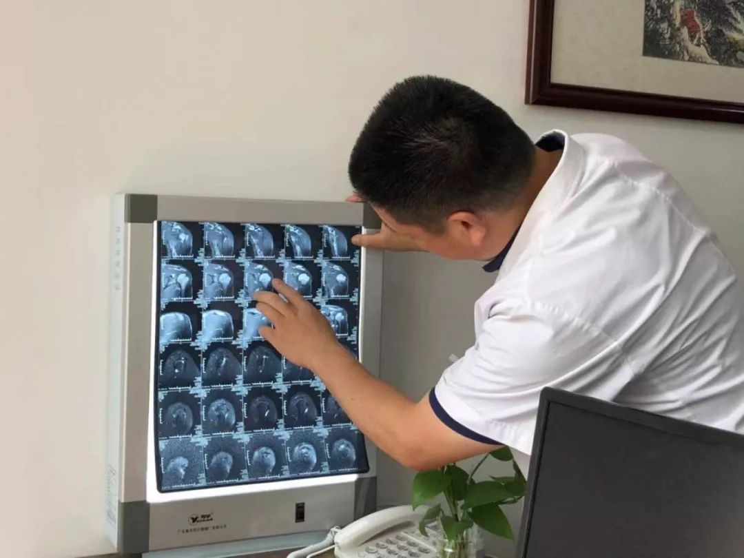 一把神妙针刀为“不死的癌症”——强直性脊柱炎患者添希望