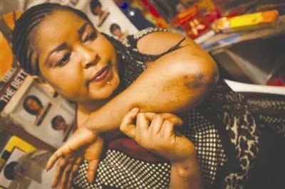 美白针真的是智商税吗,美白针有毒吗