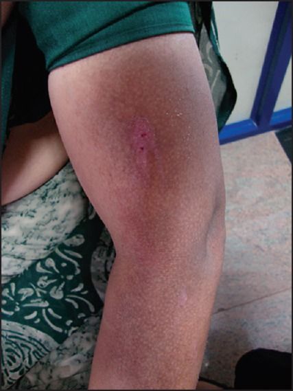 用力搓澡会让皮肤越搓越黑,身体黑搓澡可以搓白吗