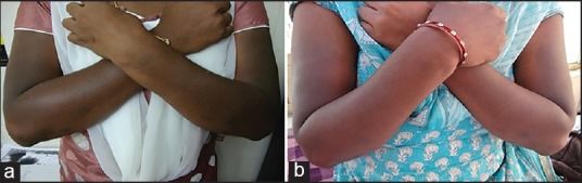 用力搓澡会让皮肤越搓越黑,身体黑搓澡可以搓白吗