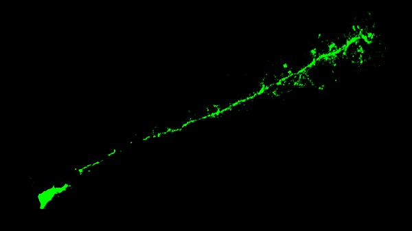 大脑损伤后的重建之谜,受伤的脑细胞可否恢复