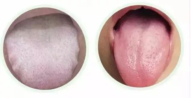 口臭推荐真实测评,白开水加一物去除口臭