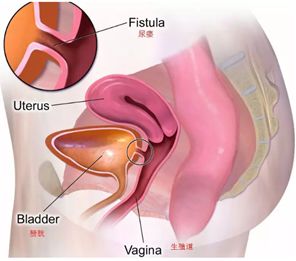 英雄or恶棍？现代妇科之父的一部女*虐性**待史