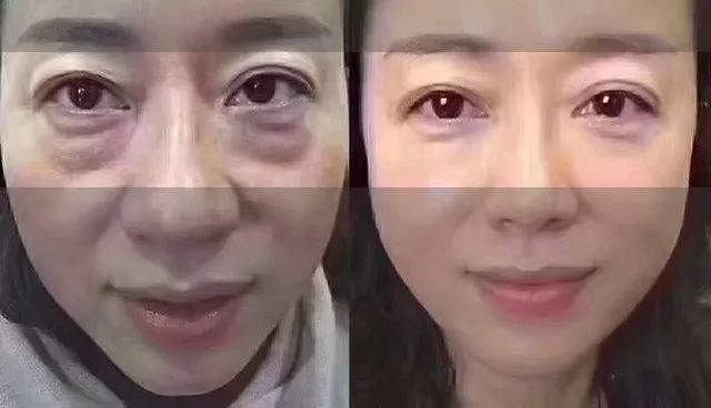 不起眼的乳膏有哪些,药店有一种不起眼的乳膏