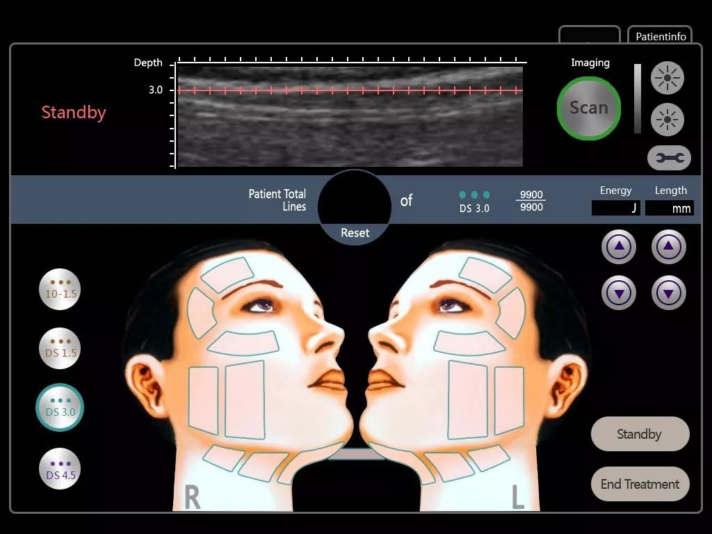关于医美的真相大全,两年医美的真实感受