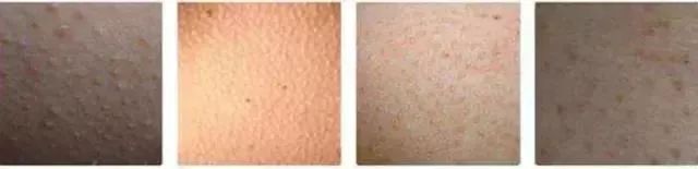 超舒服的洗澡刷,沉浸式泡浴spa团购