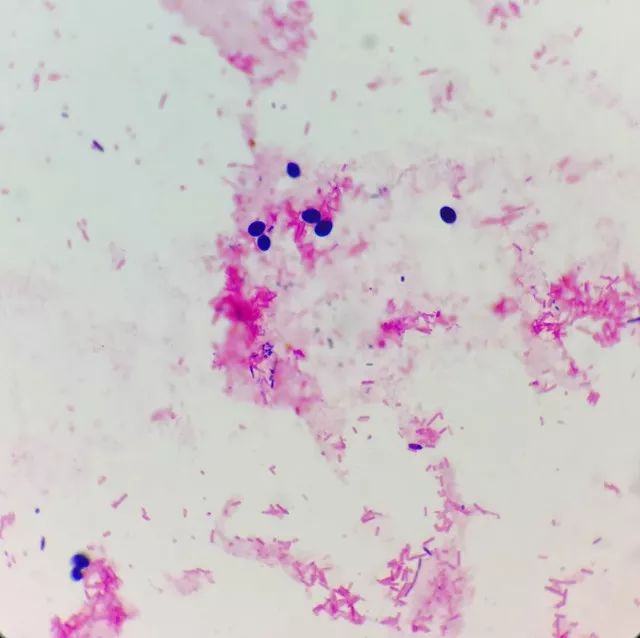 天呐,女儿大便里竟然有“霉菌”