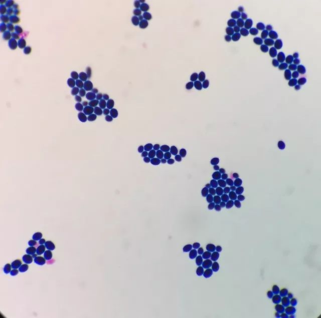 天呐,女儿大便里竟然有“霉菌”