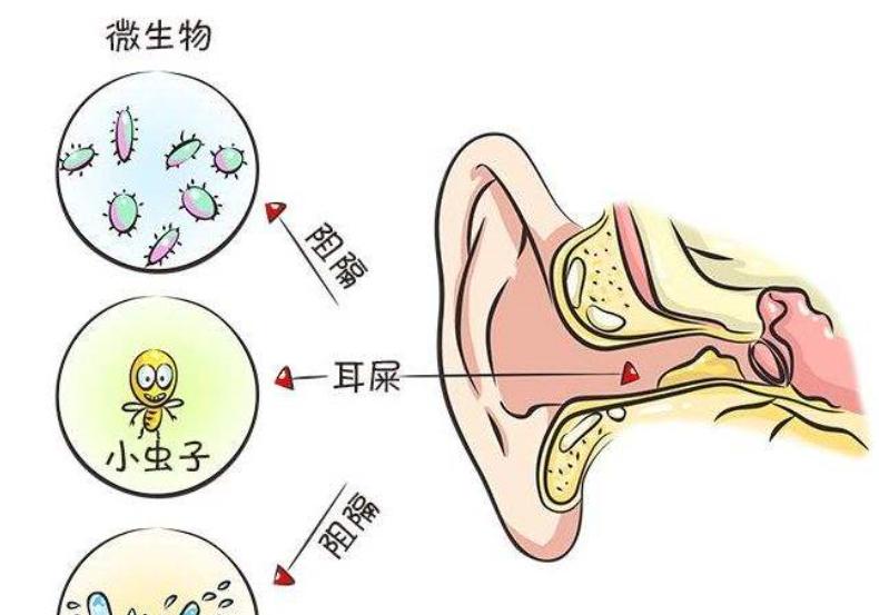 耳道小知识,关于耳屎你必须知道的几件事
