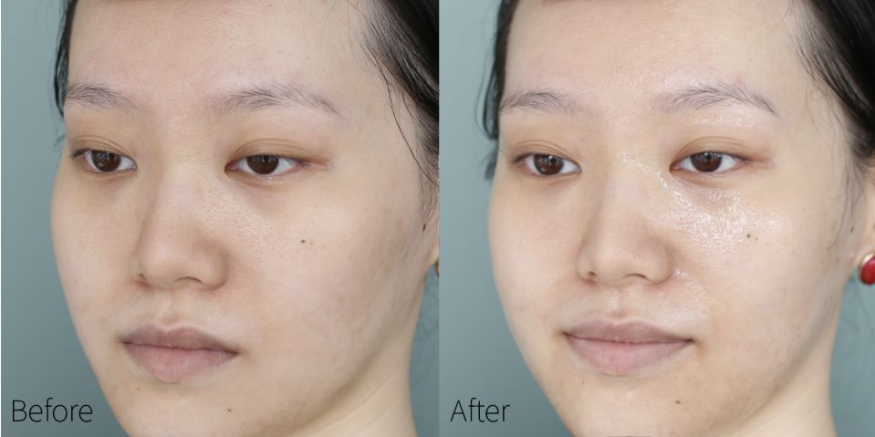 蒂佳婷哪款面膜适合晒后使用,drjart蒂佳婷紫色面膜使用方法