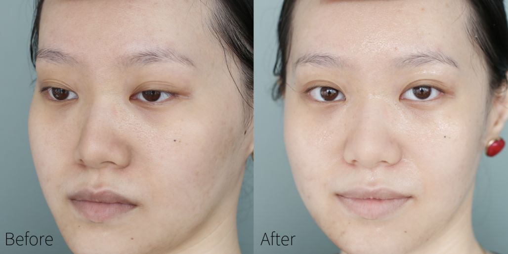 蒂佳婷哪款面膜适合晒后使用,drjart蒂佳婷紫色面膜使用方法