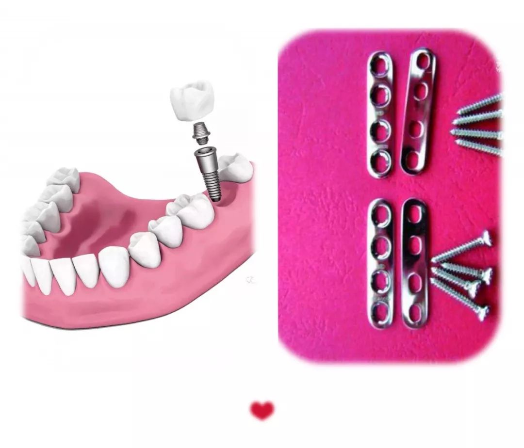 【食药科普大讲堂】干货！医疗器械的使用知识