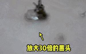 拒绝“螨虫脸”！5秒揉一揉，螨虫全出来了，痘痘黑头全没了