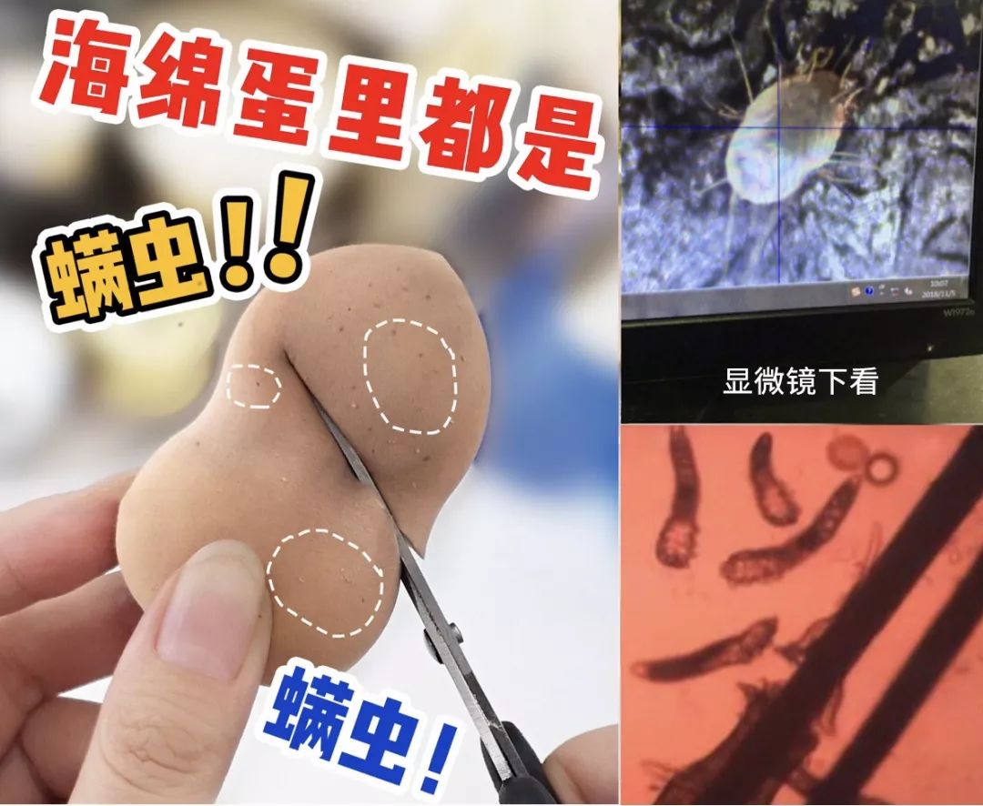 拒绝“螨虫脸”！5秒揉一揉，螨虫全出来了，痘痘黑头全没了