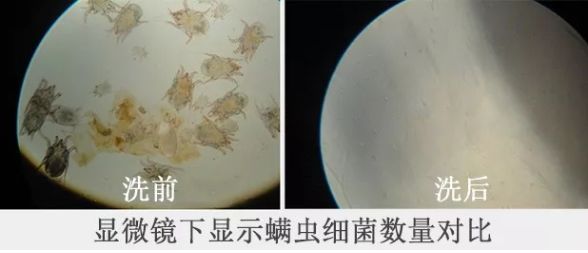 拒绝“螨虫脸”！5秒揉一揉，螨虫全出来了，痘痘黑头全没了