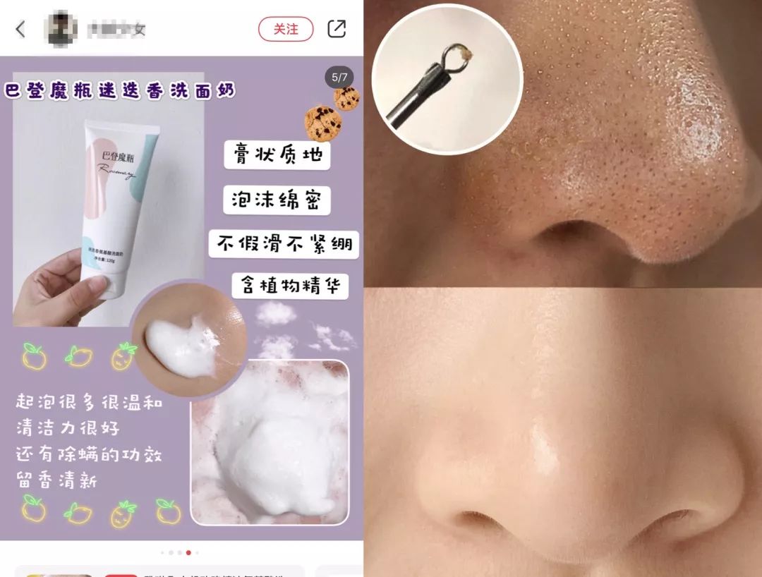 拒绝“螨虫脸”！5秒揉一揉，螨虫全出来了，痘痘黑头全没了