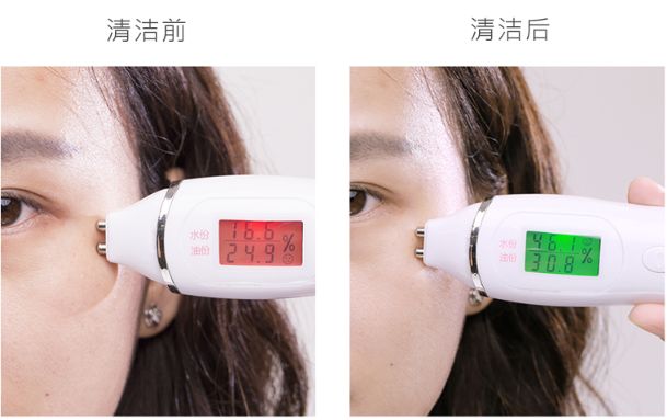 拒绝“螨虫脸”！5秒揉一揉，螨虫全出来了，痘痘黑头全没了