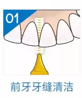 特别爱长牙石是怎么回事,长牙石是什么原因引起的