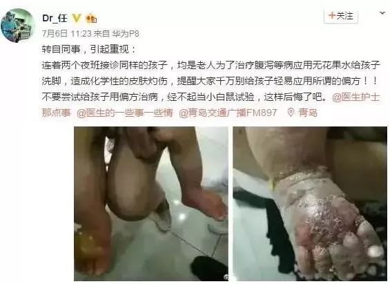六旬男子为养生吞活泥鳅,男子生吞一条活泥鳅险丢命