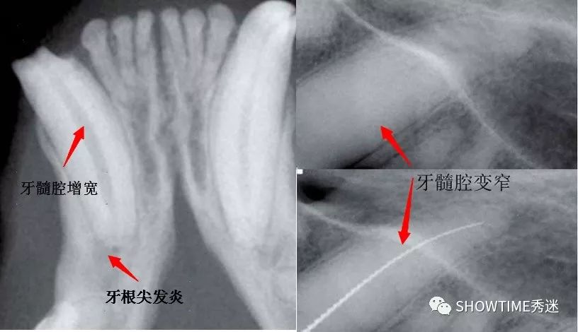 毛孩子咬了怎么办,毛孩子的牙折断