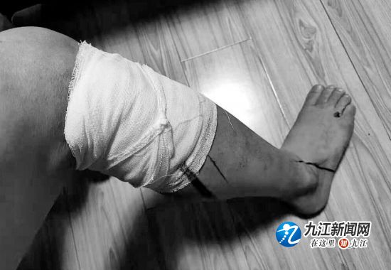 铝合金窗户划伤怎么处理,铝合金防护窗掉落