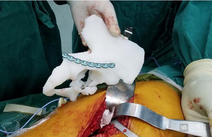 滨州市人民医院骨科于洪建,于洪建滨州市人民医院院长