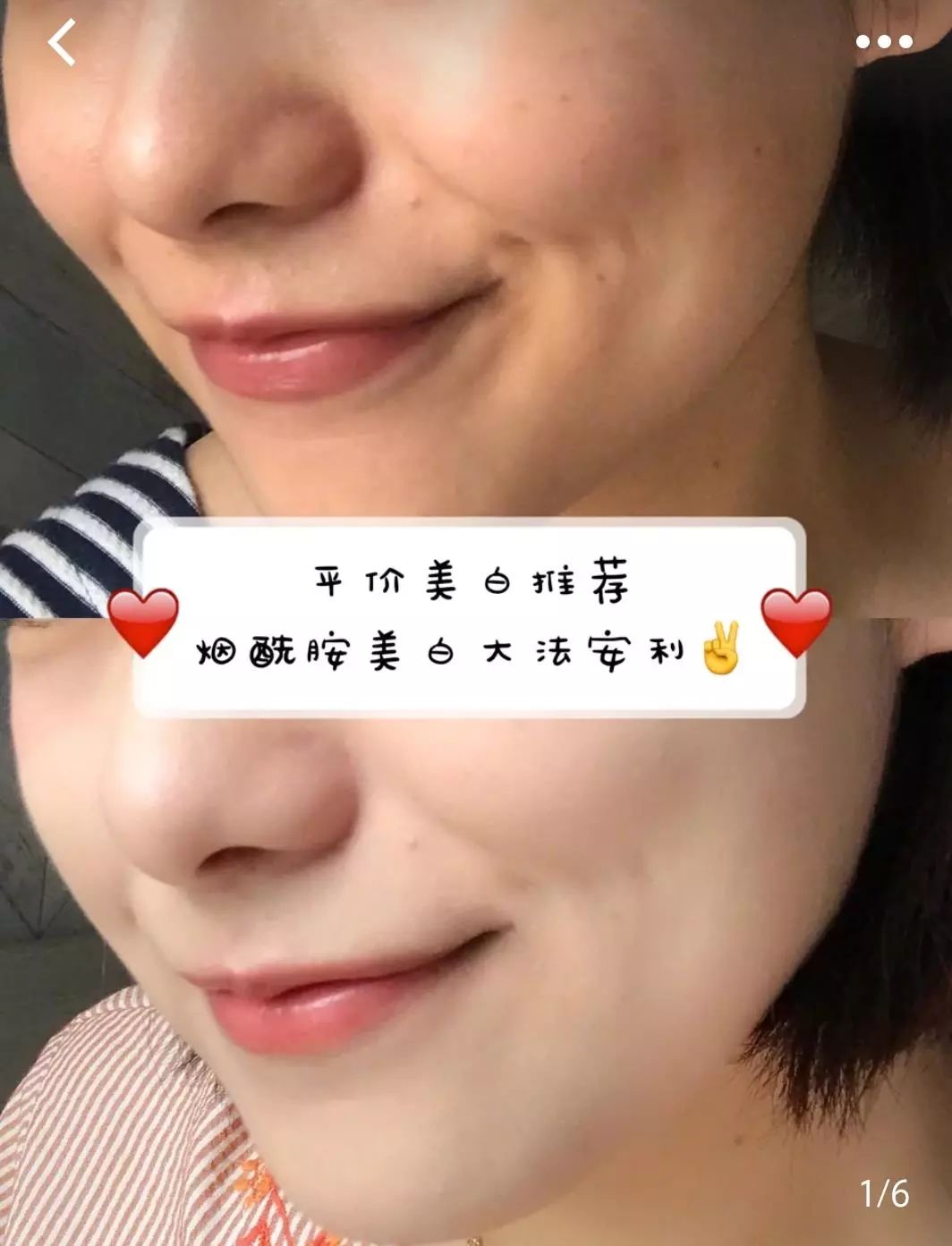 美白精华让你整个夏天都白得发光,美白精华猛料推荐