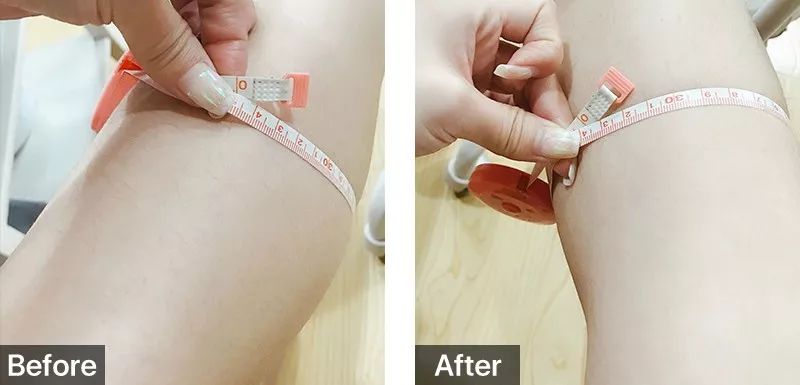 跑完步脚底痛？滚一滚它就管用，还能瘦小腿