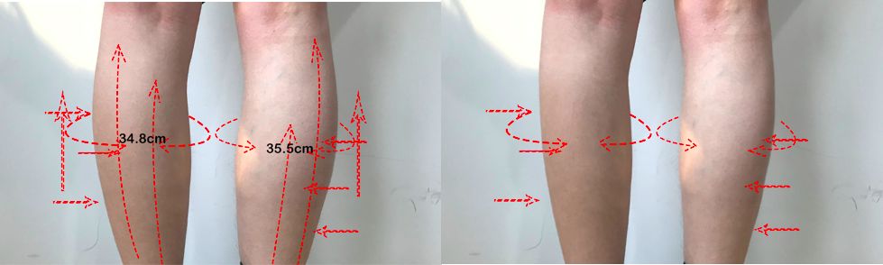 跑完步脚底痛？滚一滚它就管用，还能瘦小腿