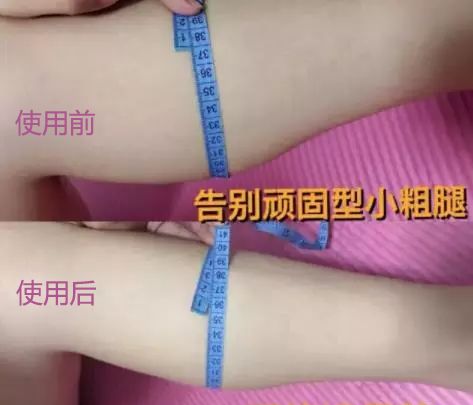 跑完步脚底痛？滚一滚它就管用，还能瘦小腿