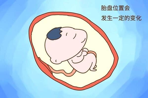 21周正常胎盘位置,前置胎盘会变位置吗
