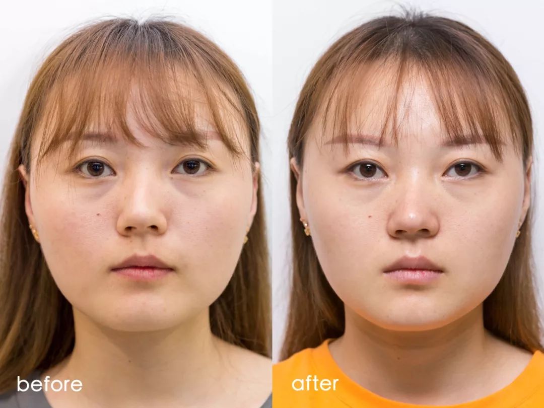 小茂肌诊室∣记一次网红咖啡店里的特别出诊